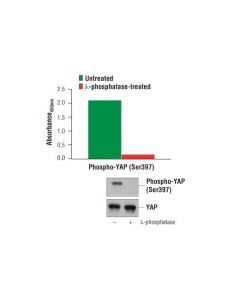 Cell Signaling Pathscan Phospho-Yap (Ser397) Sandwich Elisa Kit