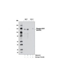 Cell Signaling Phospho-Ulk1 (Ser555) (D1h4) Rabbit mAb