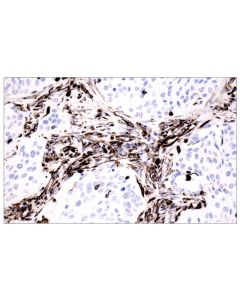 Cell Signaling Signalstain Deep Black Peroxidase Substrate Kit
