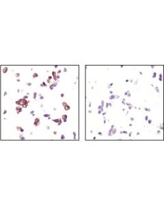 Cell Signaling Signalslide Phospho-Akt (Ser473) Ihc Controls