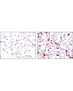 Cell Signaling Signalslide Phospho-Egf Receptor Ihc Controls