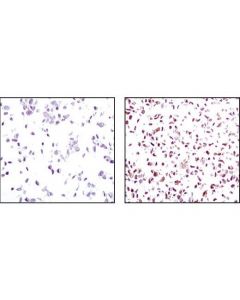 Cell Signaling Signalslide Pten Ihc Controls