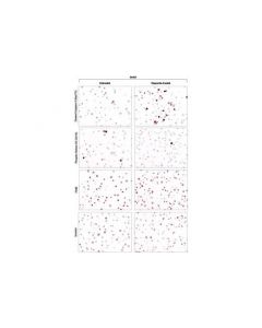 Cell Signaling Signalstain Proliferation/Apoptosis Ihc Sampler Kit