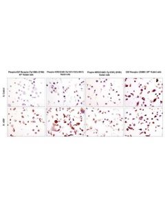 Cell Signaling Signalslide Phospho-Erbb Family Ihc Controls