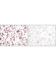 Cell Signaling Signalslide Phospho-Met (Tyr1234/1235) Ihc Controls