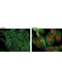 Cell Signaling Phospho-P38 Mapk (Thr180/Tyr182) (D3f9) Xp Rabbit mAb (Alexa Fluor 594 Conjugate)