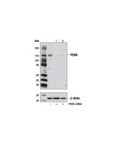 Cell Signaling Signalsilence Perk Sirna I