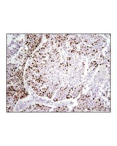 Cell Signaling Ki-67 (D2h10) Rabbit mAb (Ihc Specific)