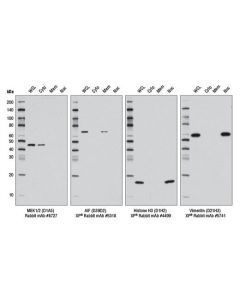 Cell Signaling Cell Fractionation Kit