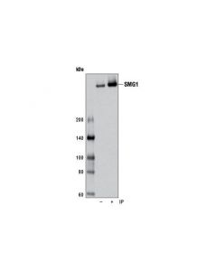 Cell Signaling Smg-1 (D42d5) Rabbit mAb