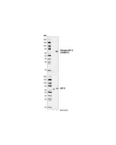 Cell Signaling Atf-2 Control Cell Extracts