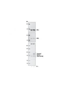 Cell Signaling Nf-Kappab Control Cell Extracts