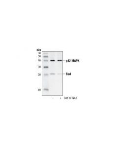 Cell Signaling Bad Antibody