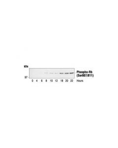 Cell Signaling Phospho-Rb (Ser807/811) Antibody