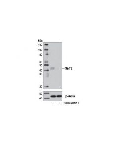Cell Signaling Signalsilence Sirt6 Sirna I