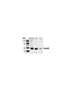 Cell Signaling Smad5 Antibody