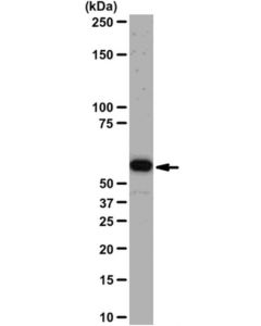 Millipore Anti-Akt1/Pkbalpha Antibody, Clone Aw24 | 04-796