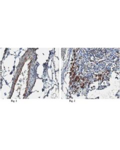 Millipore Anti-Endostatin Antibody