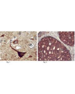 Millipore Anti-Autotaxin Antibody