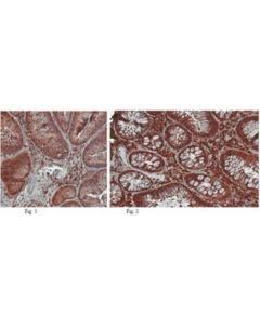 Millipore Anti-Arp2/3 Complex Antibody, Clone 13c9